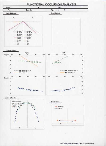 科学的アプローチで正確な咬合を実現